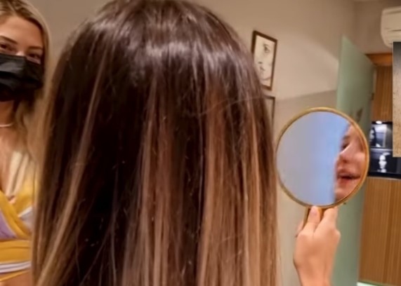 Снимката след операциите която публикува Алекс обаче не дава ясна